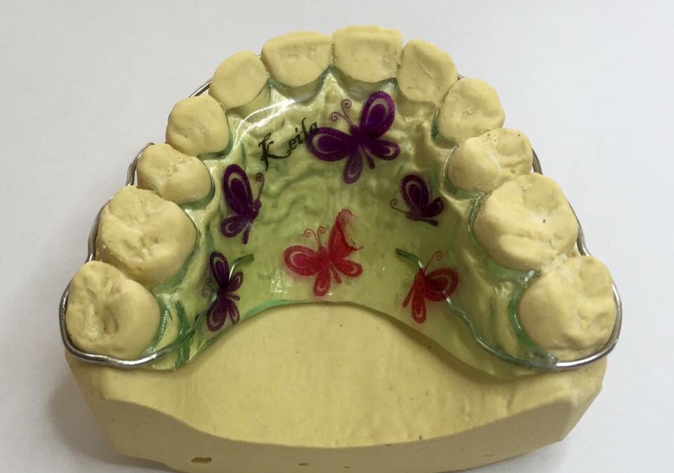 ảnh hàm nắn thường